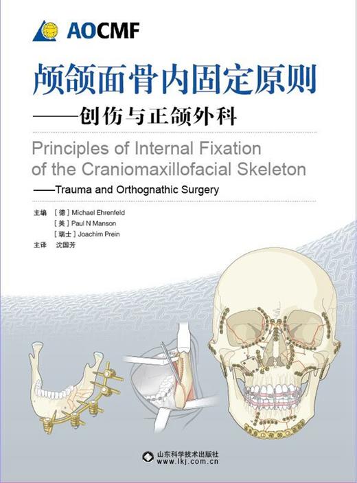 （AOCMF）颅颌面骨内固定原则—创伤与正颌外科 商品图1
